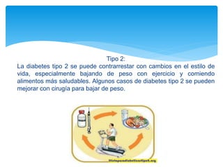 Tipo 2:
La diabetes tipo 2 se puede contrarrestar con cambios en el estilo de
vida, especialmente bajando de peso con ejercicio y comiendo
alimentos más saludables. Algunos casos de diabetes tipo 2 se pueden
mejorar con cirugía para bajar de peso.
 