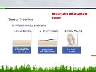 Implantable subcutaneous
sensor
 
