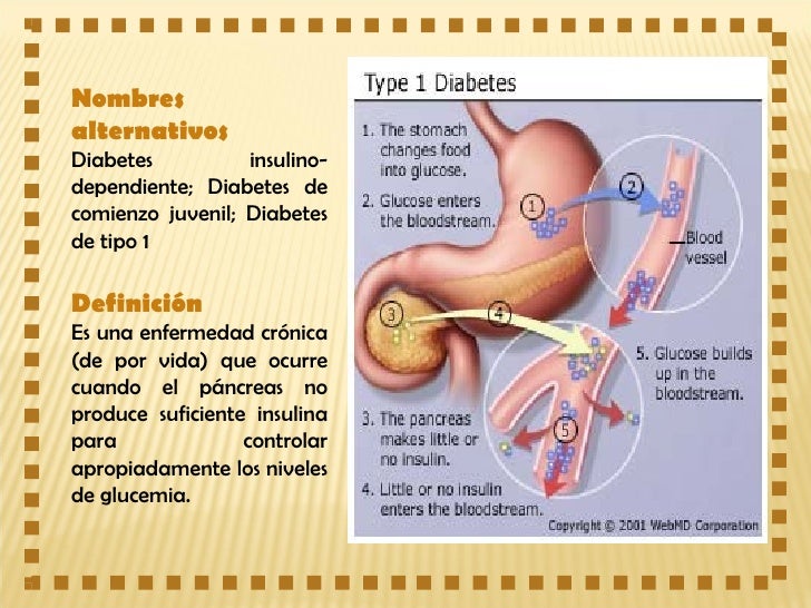DIABETES TIPO I DIABETES TIPO I