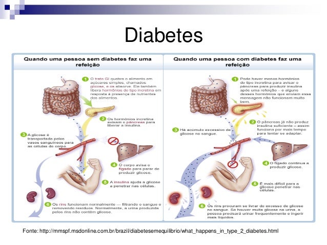 Diabetes tipo 1 tipo 2 e gestacional Diabetes tipo 1 tipo 2 e gestacional