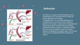 Se refiere a un grupo de enfermedades que se
caracterizan por un aumento de los niveles de
azúcar (glucosa) en la sangre.
La diabetes tipo 2 es una enfermedad que se
caracteriza por un aumento de los niveles de
glucosa en la sangre, a causa de la incapacidad del
cuerpo de producir o poder utilizar de manera
adecuada la propia insulina. La diabetes mellitus
tipo 2 se inicia en adultos, de aquí el nombre
popular de diabetes de la gente mayor. Es la forma
más común de diabetes (80-90% de todos los
casos).
Definición
 