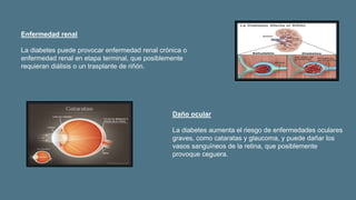 Enfermedad renal
La diabetes puede provocar enfermedad renal crónica o
enfermedad renal en etapa terminal, que posiblemente
requieran diálisis o un trasplante de riñón.
Daño ocular
La diabetes aumenta el riesgo de enfermedades oculares
graves, como cataratas y glaucoma, y puede dañar los
vasos sanguíneos de la retina, que posiblemente
provoque ceguera.
 