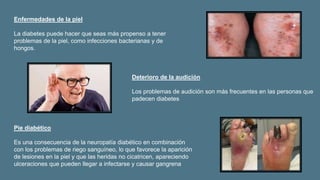 Enfermedades de la piel
La diabetes puede hacer que seas más propenso a tener
problemas de la piel, como infecciones bacterianas y de
hongos.
Deterioro de la audición
Los problemas de audición son más frecuentes en las personas que
padecen diabetes.
Pie diabético
Es una consecuencia de la neuropatía diabético en combinación
con los problemas de riego sanguíneo, lo que favorece la aparición
de lesiones en la piel y que las heridas no cicatricen, apareciendo
ulceraciones que pueden llegar a infectarse y causar gangrena
 