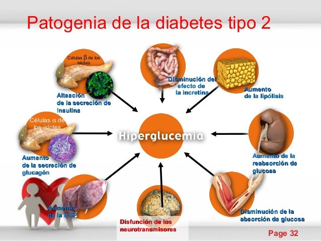 Diabetes tipo 2 de la fisio a la clinica Diabetes tipo 2 de la fisio a la clinica