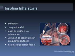 Insulina Inhalatoria Exubera® Uso preprandial Inicio de acción ≥ via subcutanea Duración de acción similar a regular subcutanea Insulina larga acción fase III Current Opinion in Anaesthesiology 2008, 21:401–405 