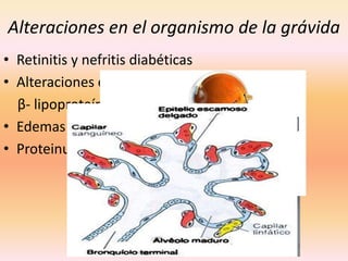 Alteraciones en el organismo de la grávida
• Retinitis y nefritis diabéticas
• Alteraciones de α-2 glucoproteínas
  β- lipoproteínas
• Edemas
• Proteinuria




              TOXEMIA PRECLÁMPLTICA
 