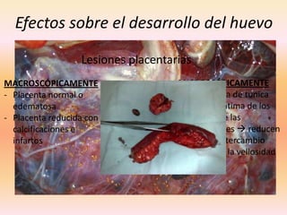 Efectos sobre el desarrollo del huevo

                  Lesiones placentarias
MACROSCÓPICAMENTE                   MICROSCÓPICAMENTE
- Placenta normal o                 - Hiperplasia de tunica
  edematosa                           media e íntima de los
- Placenta reducida con               troncos de las
  calcificaciones e                   vellosidades  reducen
  infartos                            área de intercambio
                                    - Edema de la vellosidad
 