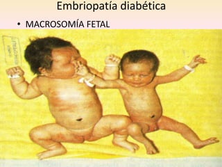 Embriopatía diabética
• MACROSOMÍA FETAL
     - 4 A 5.50 KG
     - Aumento en la longitud proporcional al peso
     - Macrosplacnia generalizada
     - Facies cushignoide
 