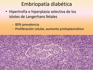 Embriopatía diabética
• Hipertrofia e hiperplasia selectiva de los
  islotes de Langerhans fetales
    - 80% prevalencia
    - Proliferación celular, aumento protoplasmático
 