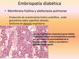 Embriopatía diabética
• Membrana hialina y atelectasia pulmonar
 - Producción de revestimiento hialino acidofílico , acido
   glucorónico sobre superficie alveolar.
 - Síndrome de diestrés respiratorio.


                         es una insuficiencia respiratoria grave debida
                         a edema pulmonar no hemodinámico causado
                         por aumento de la permeabilidad de la
                         barrera alvéolo - capilar y secundario a
                         daño pulmonar agudo.
 