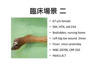 臨床場景	 二
•  67	
  y/o	
  female	
  	
  
•  DM,	
  HTN,	
  old	
  CVA	
  
•  Bedridden,	
  nursing	
  home	
  
•  Le@	
  big	
  toe	
  wound	
  	
  2mon	
  	
  
•  Fever	
  	
  since	
  yesterday	
  
•  WBC:28700,	
  CRP	
  250	
  
•  HbA1c:8.7

 