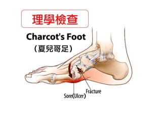 理學檢查
（夏兒哥足）

 