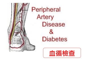 血循檢查

 