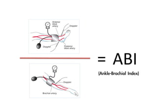 =
 ABI
(Ankle-Brachial	 Index)

 
