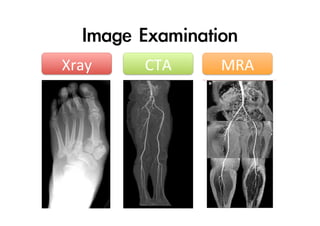 Image	 Examination
Xray

CTA

MRA

 