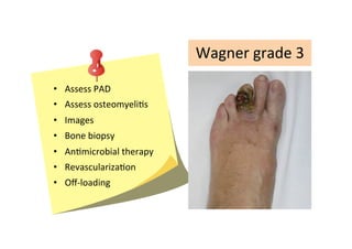 Wagner	
  grade	
  3
•  Assess	
  PAD	
  
•  Assess	
  osteomyeliZs	
  
•  Images	
  
•  Bone	
  biopsy	
  
•  AnZmicrobial	
  therapy	
  
•  RevascularizaZon	
  
•  Oﬀ-­‐loading

 