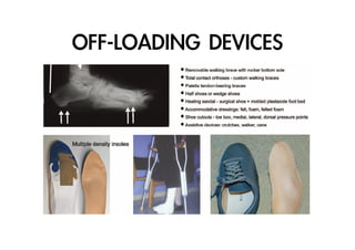 OFF-LOADING	 DEVICES

 
