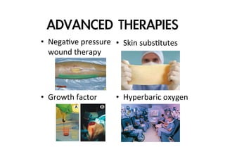 ADVANCED	 THERAPIES
•  NegaZve	
  pressure	
   •  Skin	
  subsZtutes	
  
wound	
  therapy	
  

•  Growth	
  factor	
  

•  Hyperbaric	
  oxygen

 