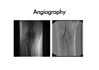 Angiography

 