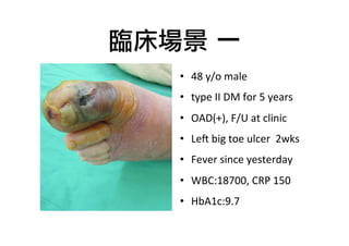 臨床場景	 一
•  48	
  y/o	
  male	
  	
  
•  type	
  II	
  DM	
  for	
  5	
  years	
  
•  OAD(+),	
  F/U	
  at	
  clinic	
  
•  Le@	
  big	
  toe	
  ulcer	
  	
  2wks	
  	
  
•  Fever	
  since	
  yesterday	
  
•  WBC:18700,	
  CRP	
  150	
  
•  HbA1c:9.7

 