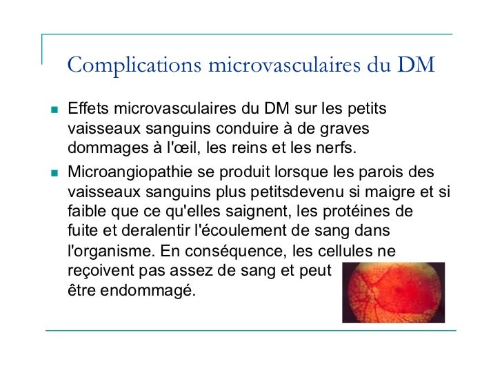 Les lamblias que cela pourquoi