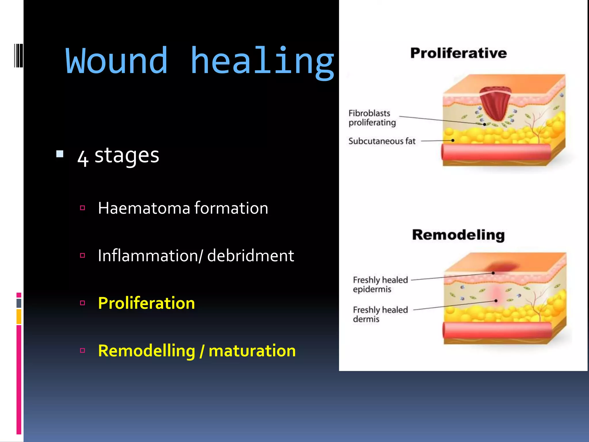 Basic Wound Care Treatment principals for simple ulcers Diabetic 2019 | PPT