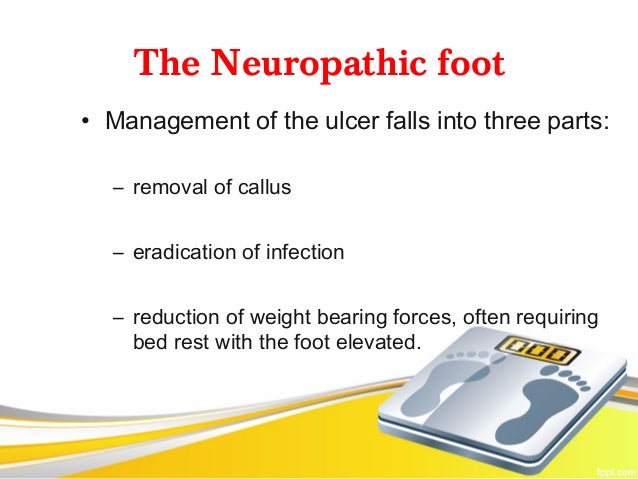 PRP Treatment for Diabetic Foot Ulcers
