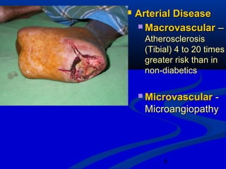 8
 Arterial DiseaseArterial Disease
 MacrovascularMacrovascular ––
AtherosclerosisAtherosclerosis
(Tibial) 4 to 20 times(Tibial) 4 to 20 times
greater risk than ingreater risk than in
non-diabeticsnon-diabetics
 MicrovascularMicrovascular --
MicroangiopathyMicroangiopathy
 
