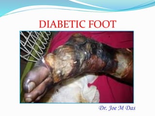 Dr. Joe M Das
DIABETIC FOOT
 