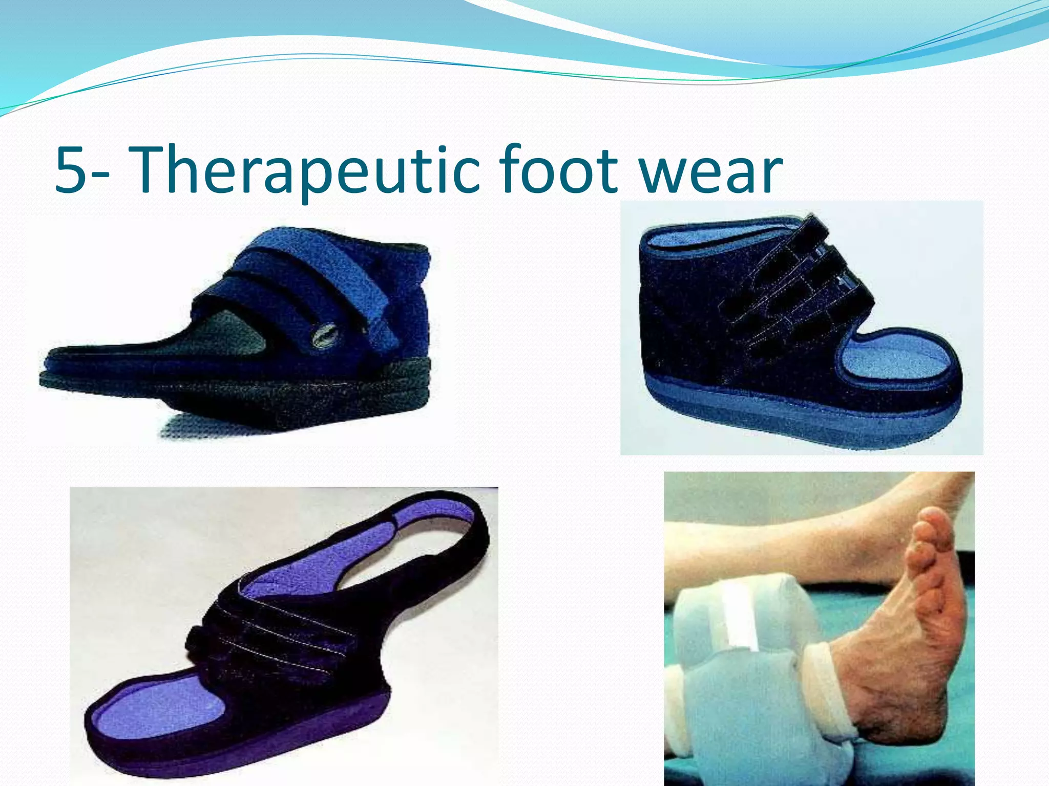management Diabetic foot | PPTX