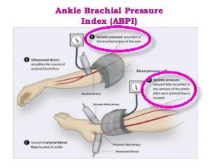 Diabetic Foot Management Overview | PDF