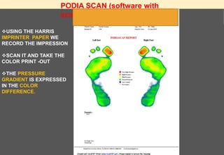 PODIA SCAN (software with
scanner)
USING THE HARRIS
IMPRINTER PAPER WE
RECORD THE IMPRESSION
SCAN IT AND TAKE THE
COLOR PRINT -OUT
THE PRESSURE
GRADIENT IS EXPRESSED
IN THE COLOR
DIFFERENCE.
 