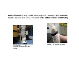 • Removable devices may also be more pragmatic choices for less motivated
patients because they allow patients to bathe and sleep more comfortably
 