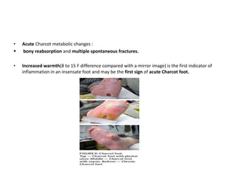 • Acute Charcot metabolic changes :
 bony reabsorption and multiple spontaneous fractures.
• Increased warmth(8 to 15 F difference compared with a mirror image) is the first indicator of
inflammation in an insensate foot and may be the first sign of acute Charcot foot.
 