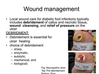 Wound management
• Local wound care for diabetic foot infections typically
includes debridement of callus and necrotic tissue,
wound cleansing, and relief of pressure on the
ulcer
DEBRIDMENT:
• Debridement is essential for
ulcer healing
• choice of debridement
– sharp,
– enzymatic,
– autolytic,
– mechanical, and
– biological)
Fig: Neuropathic ulcer
Top: Pre debridement
 