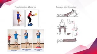 Buerger Allen Exercise
Proprioception & Balance
 