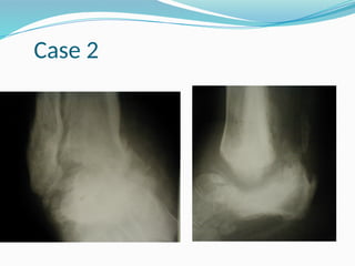 Case 2
 