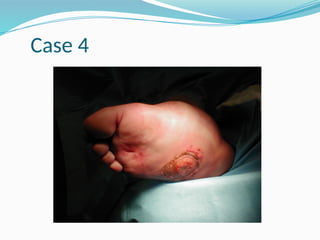 Case 4
 