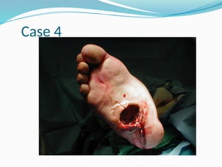 Case 4
 