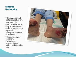 Diabetic
Neuropathy
History & careful
foot examination are
mandatory to
diagnose neuropathy
Up to 50%of type2
diabetic patient have
significant
neuropathy & at risk
of foot ulcer
Sensorimotor &
peripheral
sympathatic
neuropathy are
major risk factors for
ulcer
 