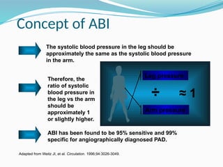 Concept of ABI
ABI has been found to be 95% sensitive and 99%
specific for angiographically diagnosed PAD.
The systolic blood pressure in the leg should be
approximately the same as the systolic blood pressure
in the arm.
Therefore, the
ratio of systolic
blood pressure in
the leg vs the arm
should be
approximately 1
or slightly higher.
Adapted from Weitz JI, et al. Circulation. 1996;94:3026-3049.
Arm pressure
Leg pressure
÷ ≈ 1
 