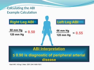 Calculating the ABI
Example Calculation
66 mm Hg
120 mm Hg
Hiatt WR. N Engl J Med. 2001;344:1608-1621.
= 0.50 = 0.55
Right Leg ABI Left Leg ABI
60 mm Hg
120 mm Hg
Right Leg ABI
ABI Interpretation
≤ 0.90 is diagnostic of peripheral arterial
disease
 