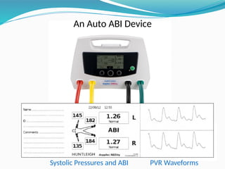 An Auto ABI Device
Systolic Pressures and ABI PVR Waveforms
 