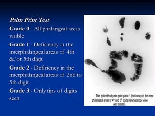 Palm Print Test
Grade 0 - All phalangeal areas
visible
Grade 1 - Deficiency in the
interphalangeal areas of 4th
&/or 5th digit
Grade 2 - Deficiency in the
interphalangeal areas of 2nd to
5th digit
Grade 3 - Only tips of digits
seen
 