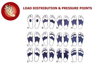 LOAD DISTRIBUTION & PRESSURE POINTS
MIS
 