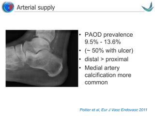 Vascular surgery @ Tallaght
Arterial supply
Poitier et al, Eur J Vasc Endovasc 2011
• PAOD prevalence
9.5% - 13.6%
• (~ 50% with ulcer)
• distal > proximal
• Medial artery
calcification more
common
 