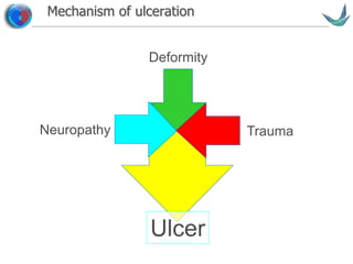 Vascular surgery @ Tallaght
Mechanism of ulceration
Neuropathy
Deformity
Trauma
Ulcer
 