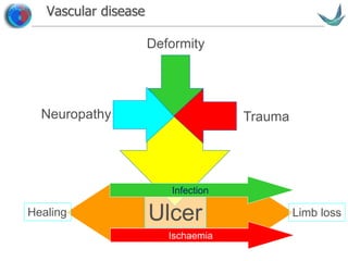 Vascular surgery @ Tallaght
Vascular disease
Neuropathy
Deformity
Trauma
UlcerHealing Limb loss
Ischaemia
Infection
 