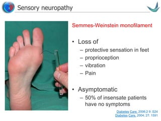 Vascular surgery @ Tallaght
Semmes-Weinstein monofilament
• Loss of
– protective sensation in feet
– proprioception
– vibration
– Pain
• Asymptomatic
– 50% of insensate patients
have no symptoms
Sensory neuropathy
Diabetes Care. 2006;2 9: S24
Diabetes Care. 2004; 27: 1591
 