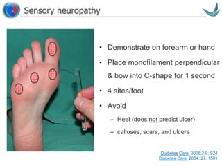 Vascular surgery @ Tallaght
• Demonstrate on forearm or hand
• Place monofilament perpendicular
& bow into C-shape for 1 second
• 4 sites/foot
• Avoid
– Heel (does not predict ulcer)
– calluses, scars, and ulcers
Sensory neuropathy
Diabetes Care. 2006;2 9: S24
Diabetes Care. 2004; 27: 1591
 